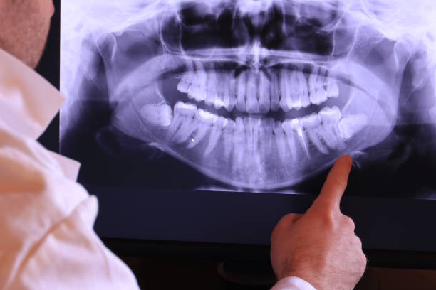 Best Emergency Dental Surgery in Falls City, NE