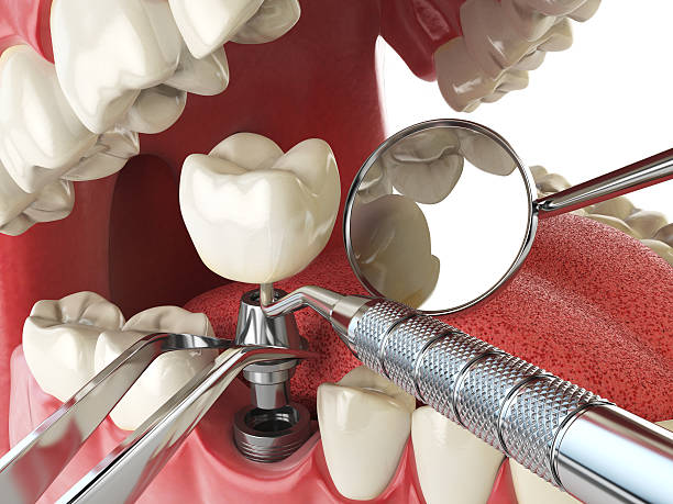 Best Emergency Dental Surgery in Falls City, NE